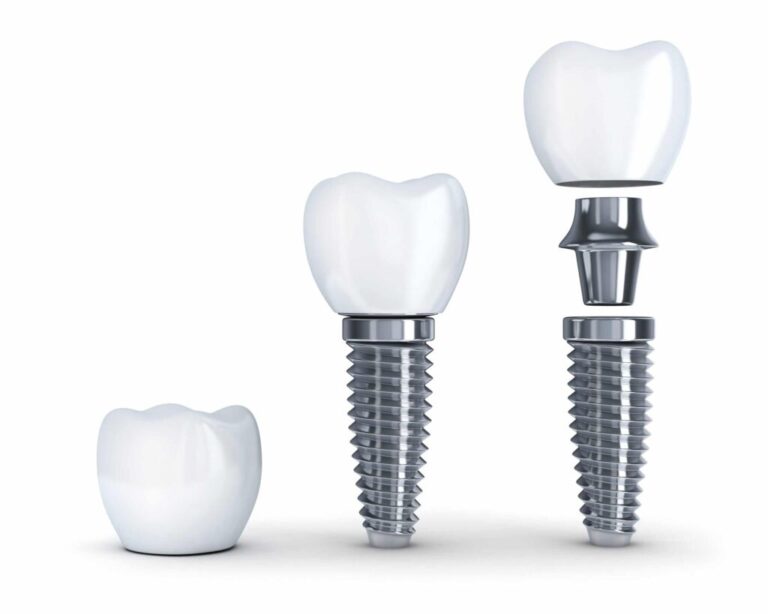 dental-iml